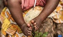 乌克兰爆料猴痘事件视频,揭秘病毒传播真相